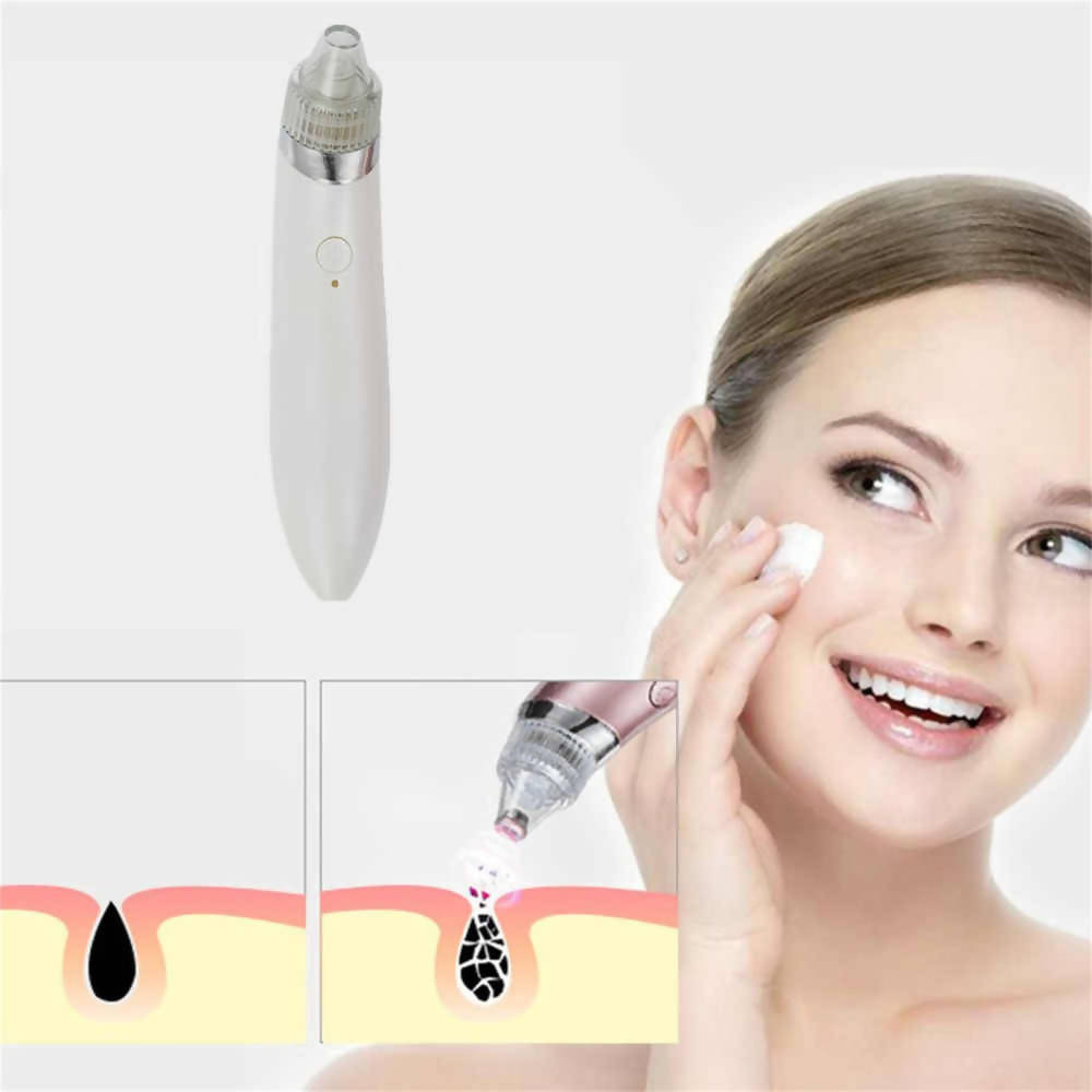 MSQ Blackhead Vacuum Suction Pore Cleaner Rechargeable Professional Portable Ultrasonic Vibration Electric Blackheads Suction Remover Clean Skin Care Pore Beauty Instrument